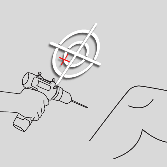 Illustration for "An Evaluation of Spatial Anchoring to position AR Guidance in Arthroscopic Surgery"